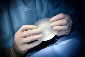 A doctor holding an implant